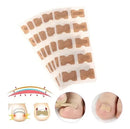 Encravax - Parches Para Hongos y Uñas Encarnadas (PIDE 10 y LLEVA 20)