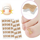 Encravax - Parches Para Hongos y Uñas Encarnadas (PIDE 10 y LLEVA 20)