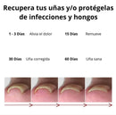 Tratamiento para eliminar Hongos de uña 100% Natural🍃 - ¡Compra 1 y llévate 2 gratis!