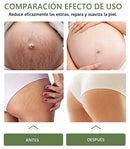 CREMA ANTIESTRÍAS SKINREPAIR